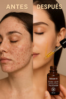 Compre 1 y Llévate 2 - Sérum 10 Ácido Kojic + Niacinamida + REGALO: Contorno de Ojos con Colágeno